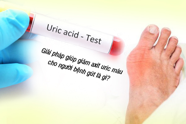 Giải pháp giúp giảm axit uric máu cho người bệnh gút là gì?